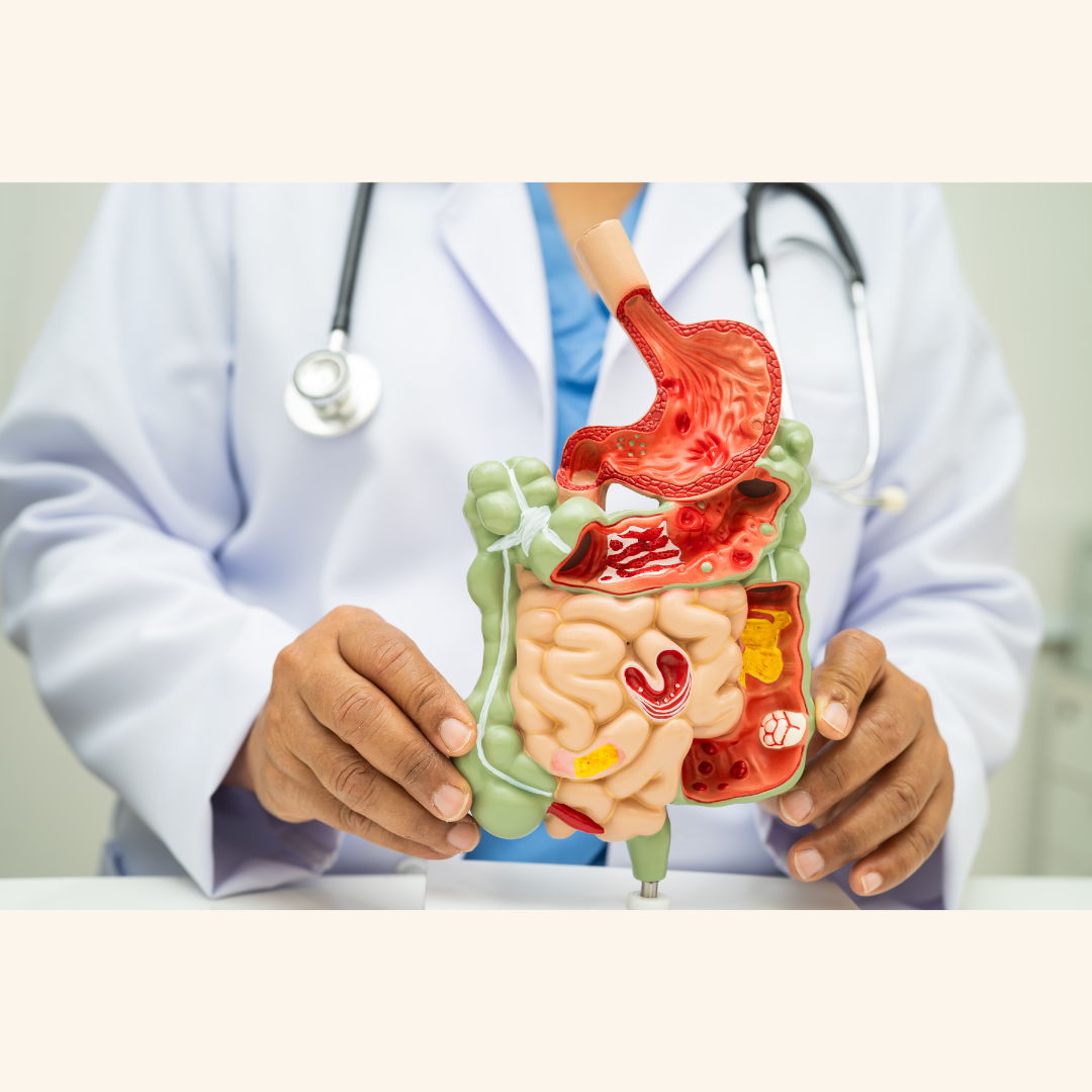 The "Second Brain" Rebellion: How the Gut Drives Parkinson’s