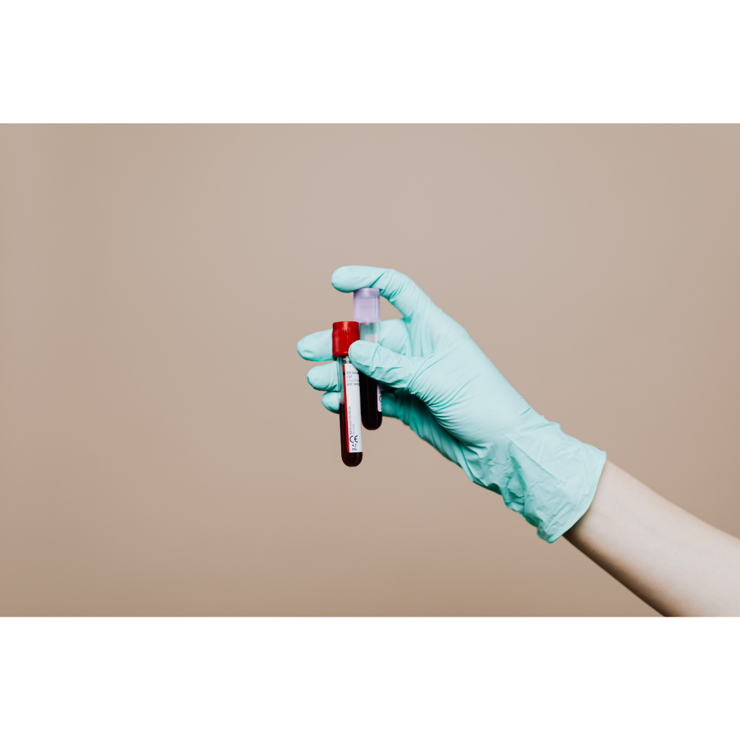 Finding Early Signs of Parkinson’s in the Blood
