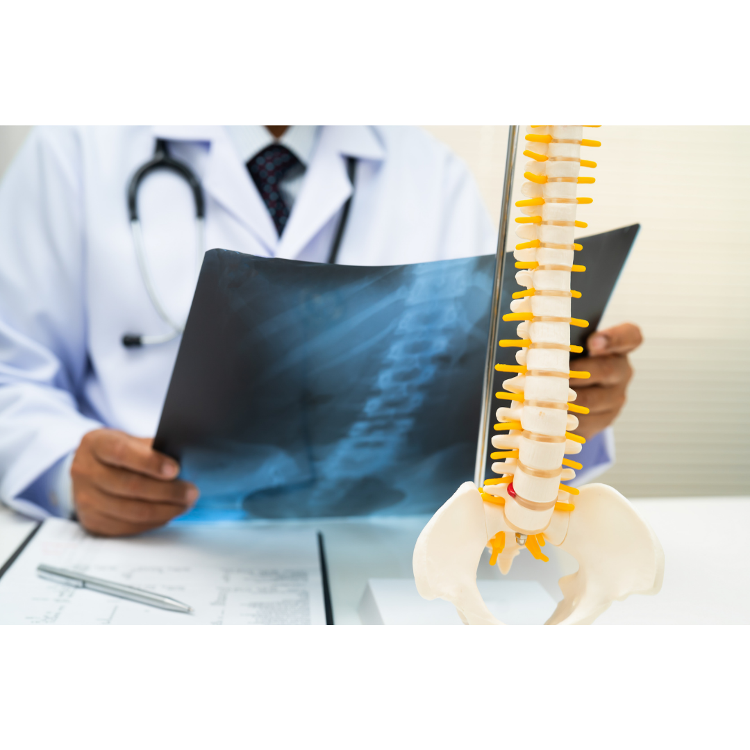 The Bone-Brain Axis: How Your Skeleton Influences Parkinson’s