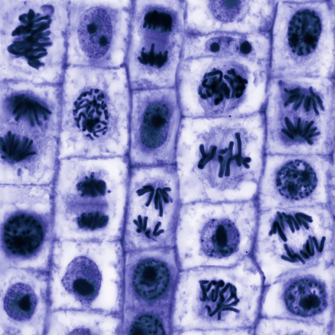 Oryon Cell Therapies: Personalised Healing for Parkinson’s
