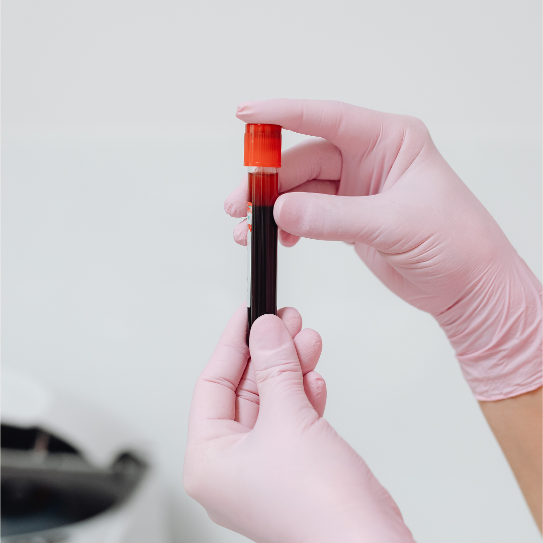 New Blood Test Could Reveal Biological Roots of Early-Onset Parkinson’s