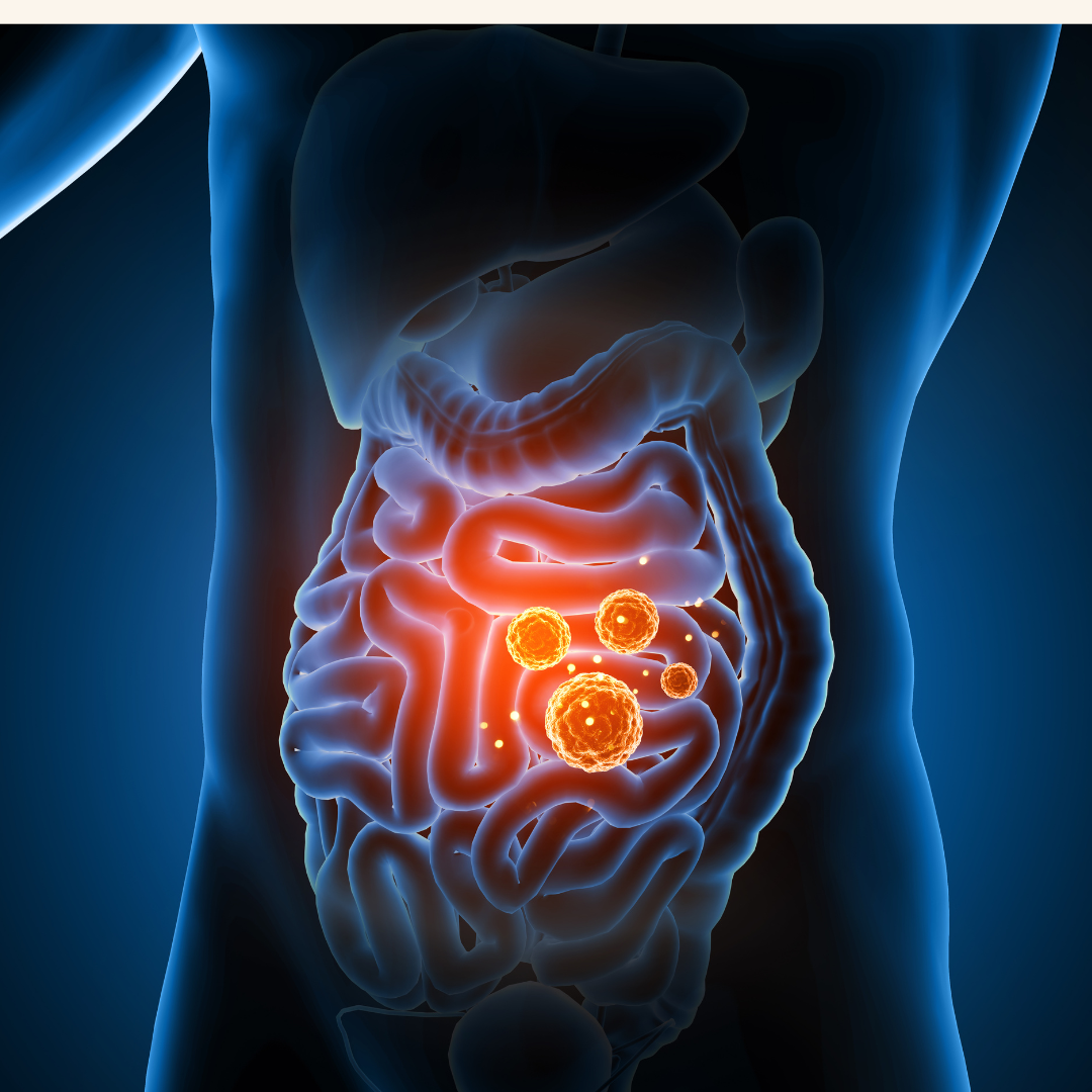 Healthy gut barriers and balanced fats are vital for protecting the brain