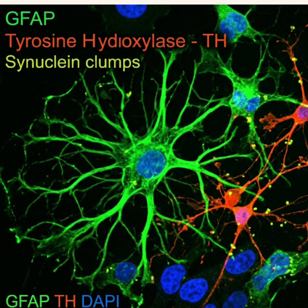Brain support cells can turn toxic and damage dopamine neurons