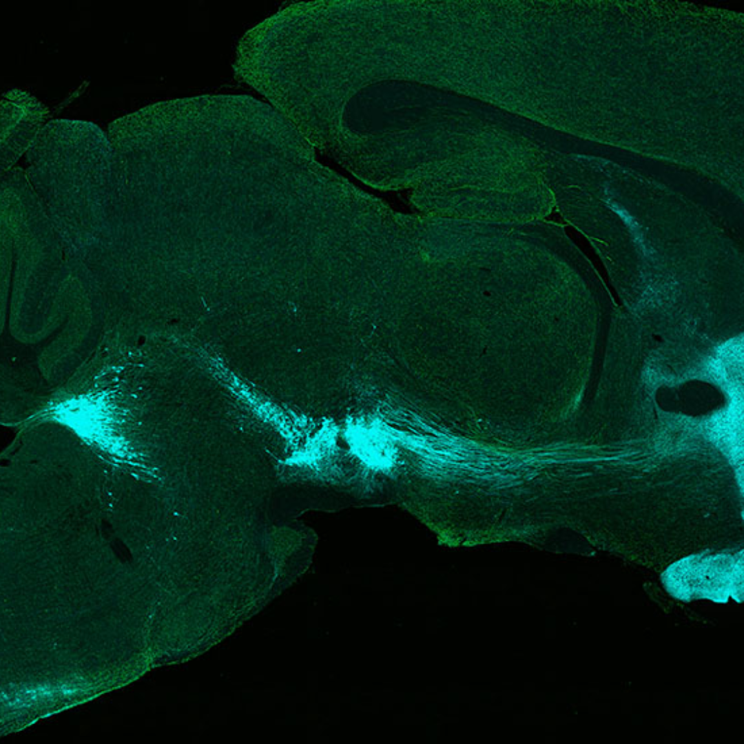 Harvard researchers uncover brain sensor mix up that could impact Parkinson's research