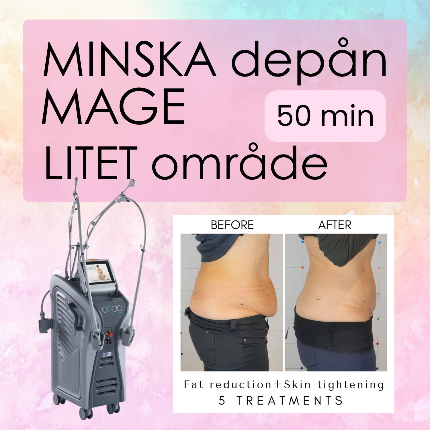 Minska DEPÅN över MAGEN - Litet område
