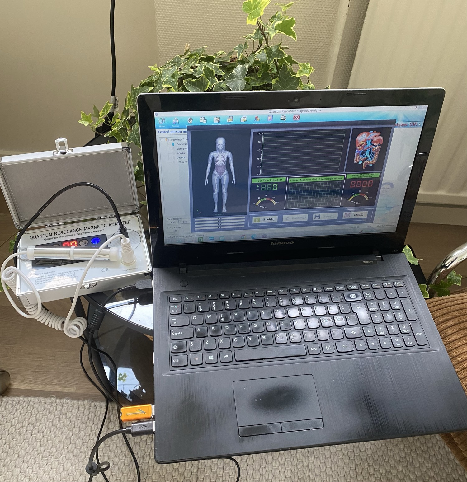 QMRA Frekvens - hälsoanalys BAS med rådgivning