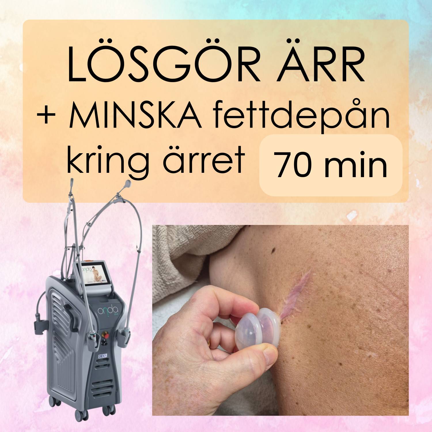 Lösgöring av ÄRR + minska fettdepån kring ärret