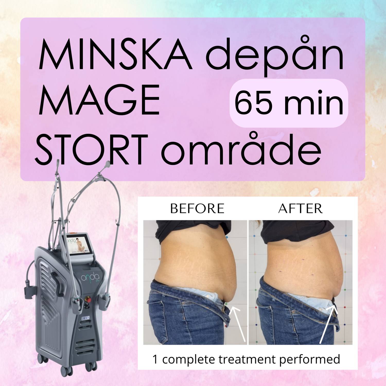 Minska DEPÅN över MAGEN - Stort område
