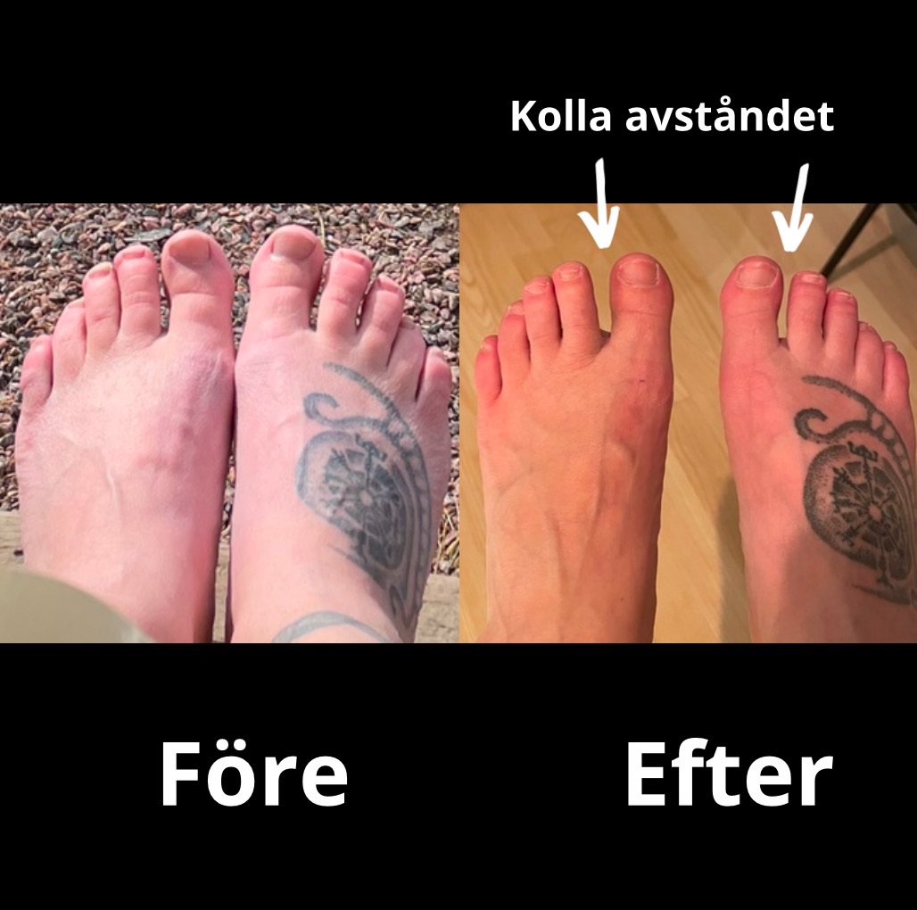 Workshop - Funktionella fötter
