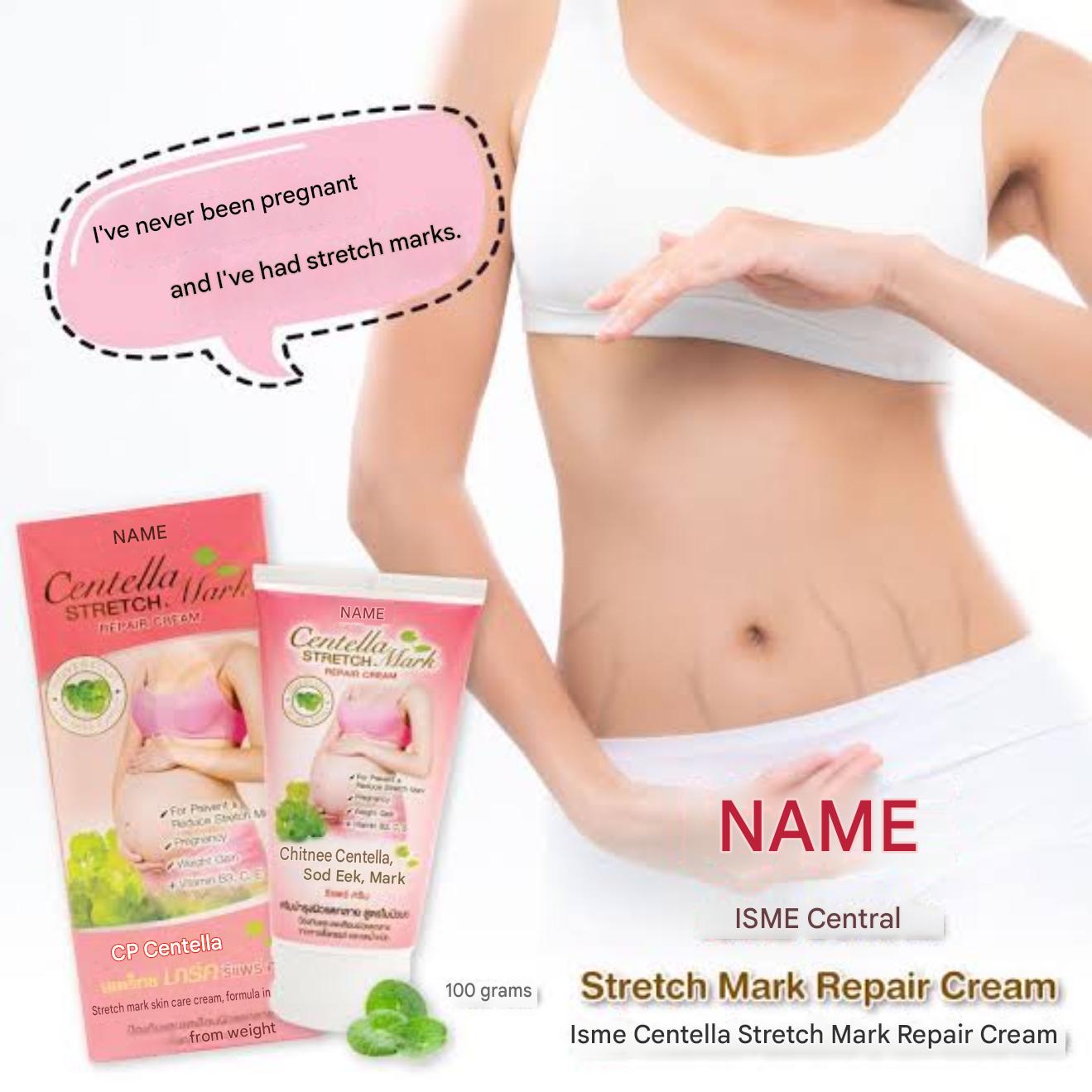 Stretch mark repair cream 100 ml