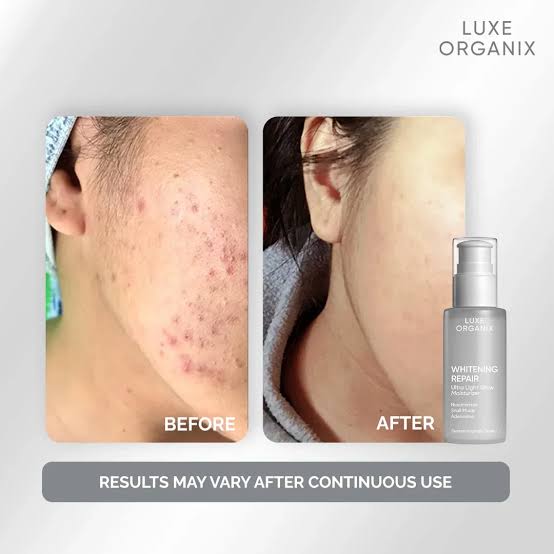 Luxe Organix, Whitening Repair Ultra Light Glow Moisturizer 80ml