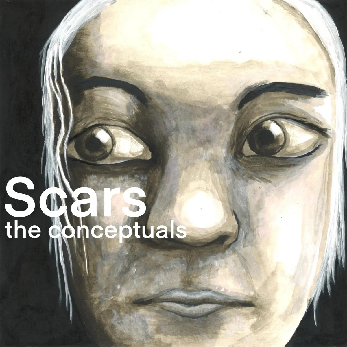 Scars