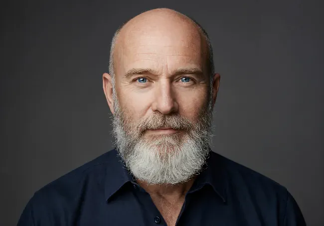 Direct Gaze of Bald Man