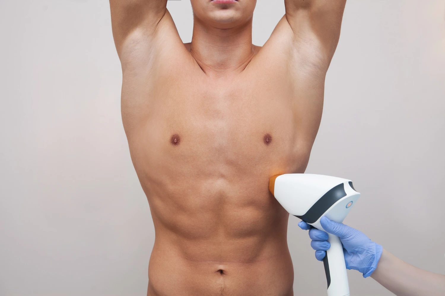 הסרת שיער בלייזר לגברים ברמת גן – מראה חלק ונקי | ענבל ויס