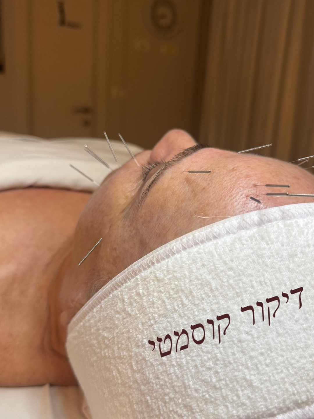 טיפול משולב עיסוי + דיקור