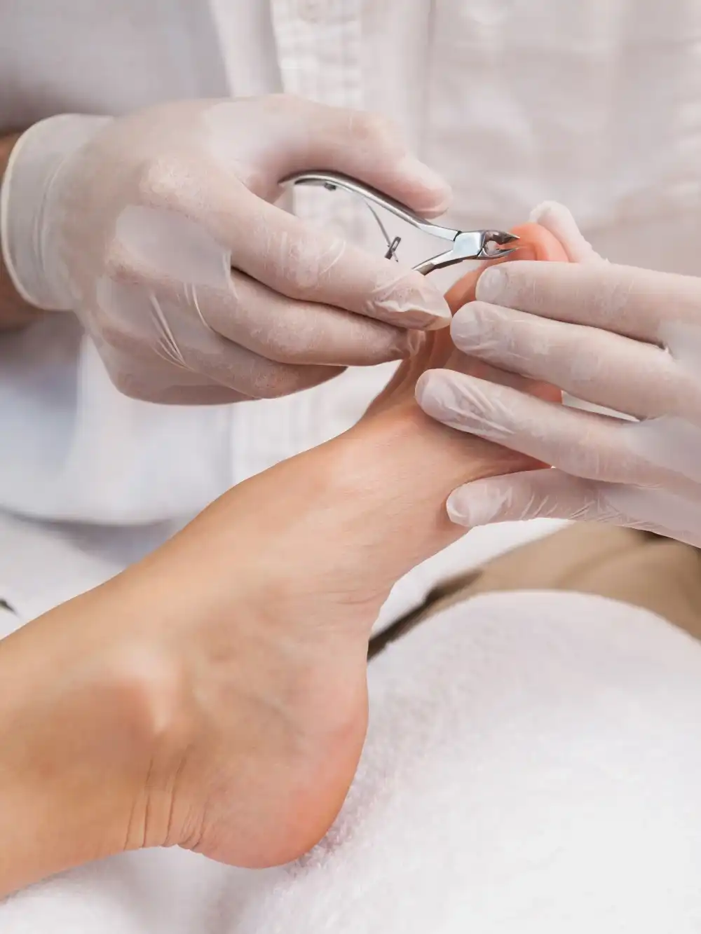 אורטונוקסיה- טיפול באמצעות גשרים (לציפורן חודרנית ומעוותת)