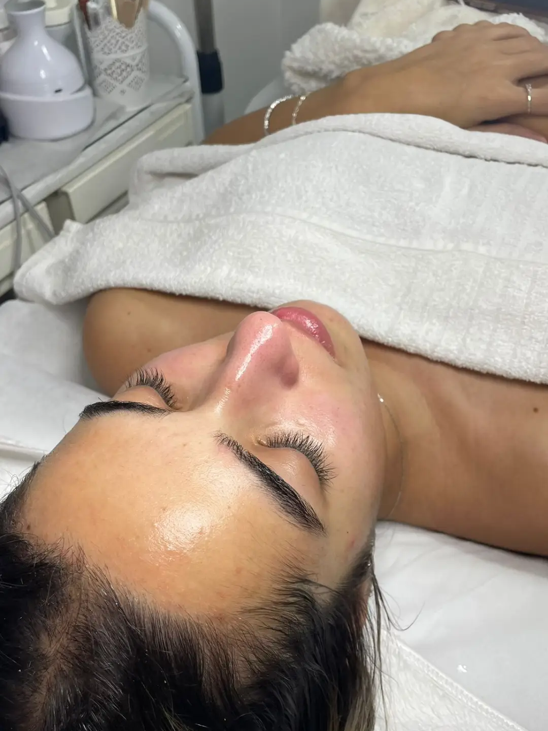 טיפולי מזותרפיה בראשון לציון | AC cosmetics