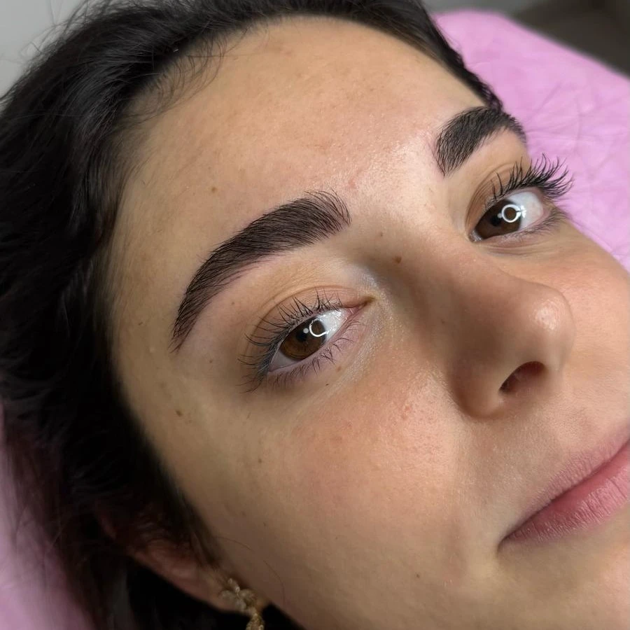 מיקרובליידינג