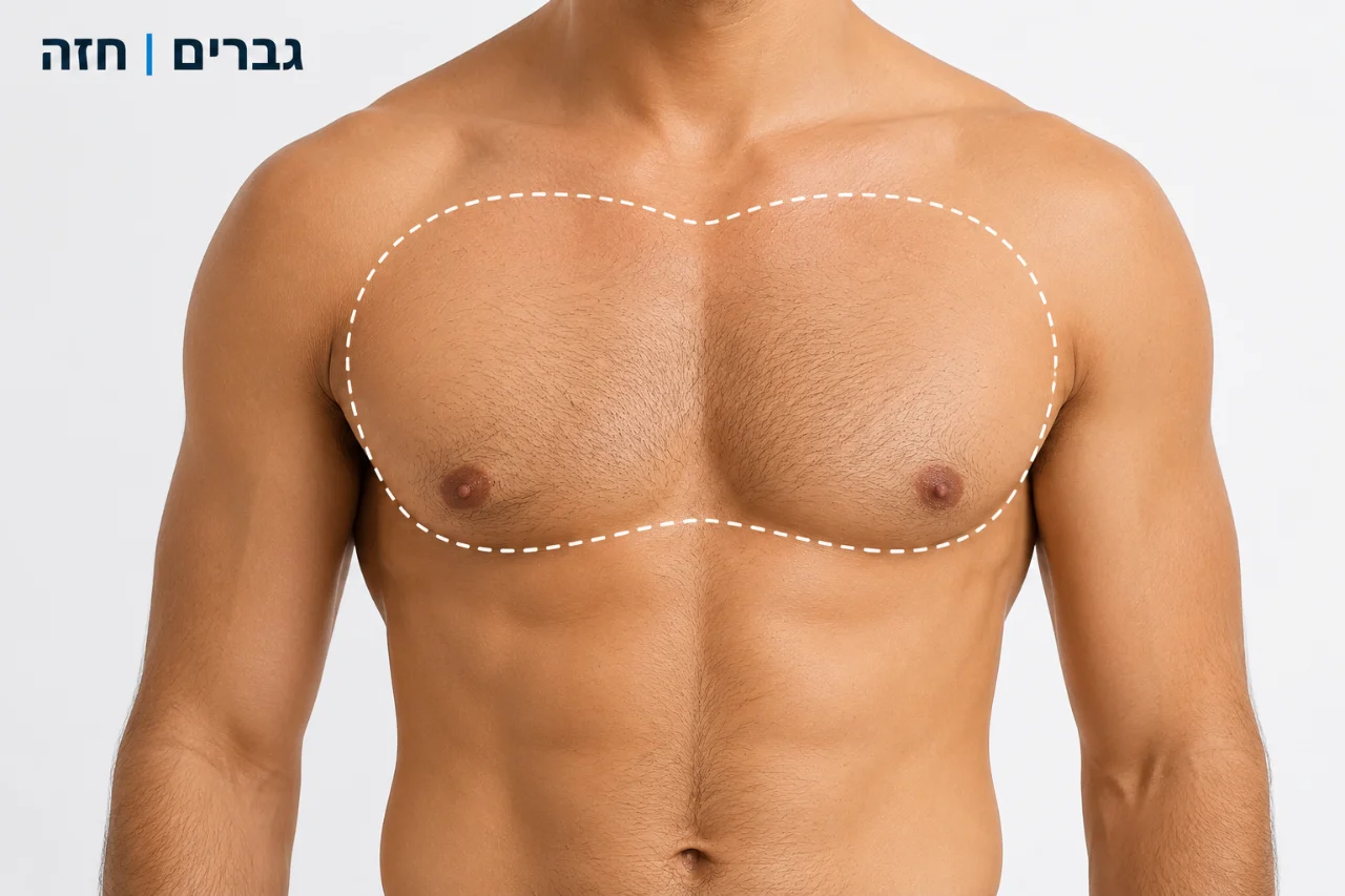 הסרת שיער חזה גבר 10 טיפולים