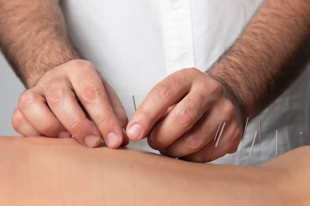 דיקור סיני ויפני למבוגרים