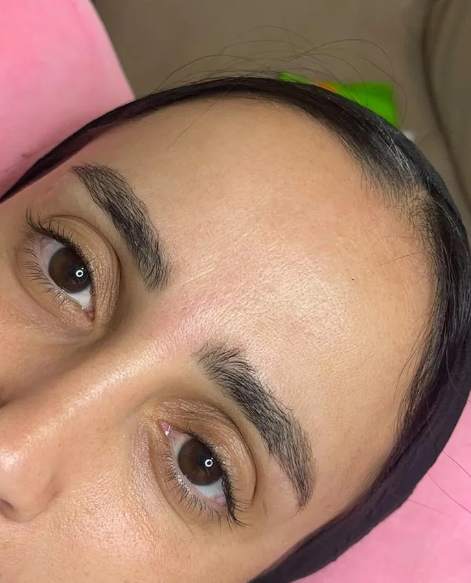 מיקרובלידינג לטיפול אחד