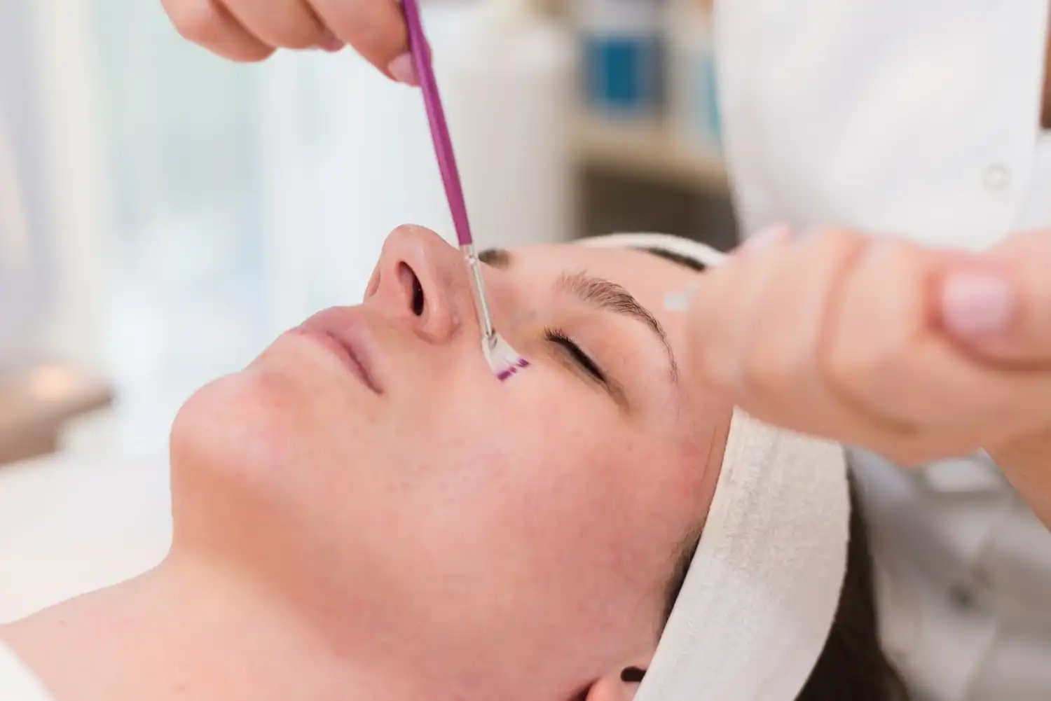 טיפול באקנה ופוסט-אקנה