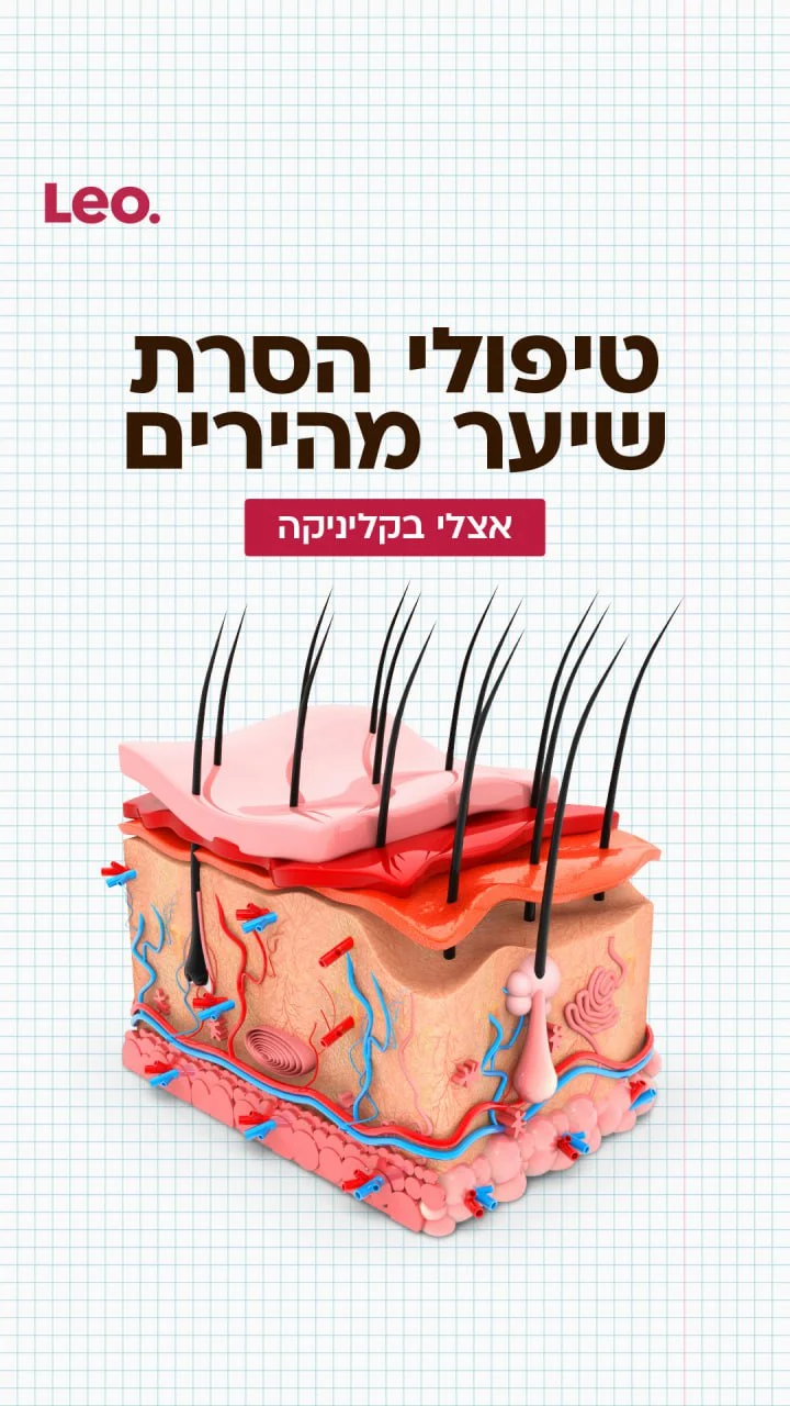 טיפול הסרת שיער