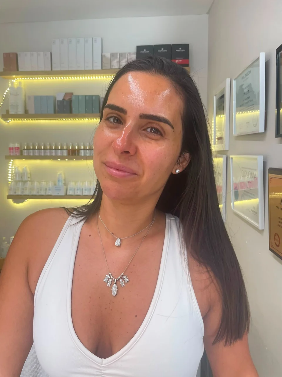 טיפול זוהר והחדרת לחויות