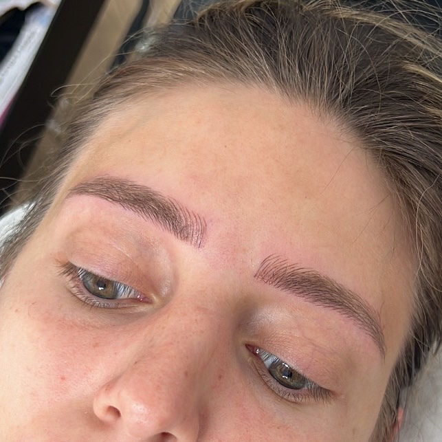 מיקרובליידינג