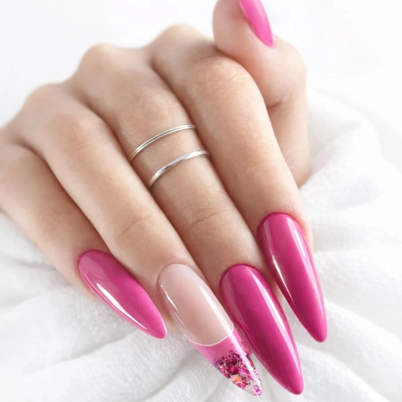 השתלמות קישוטים