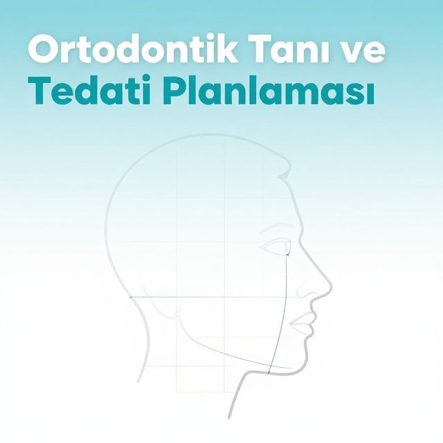 Ortodontik Tanı ve Tedavi Planlaması