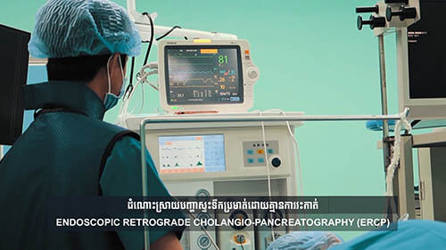 ERCP Technology