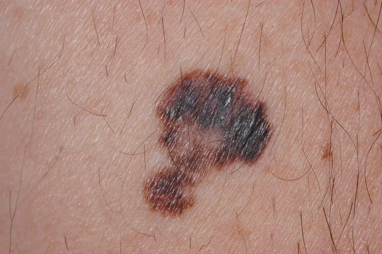 Close-up clinical photograph of the skin of an adult man