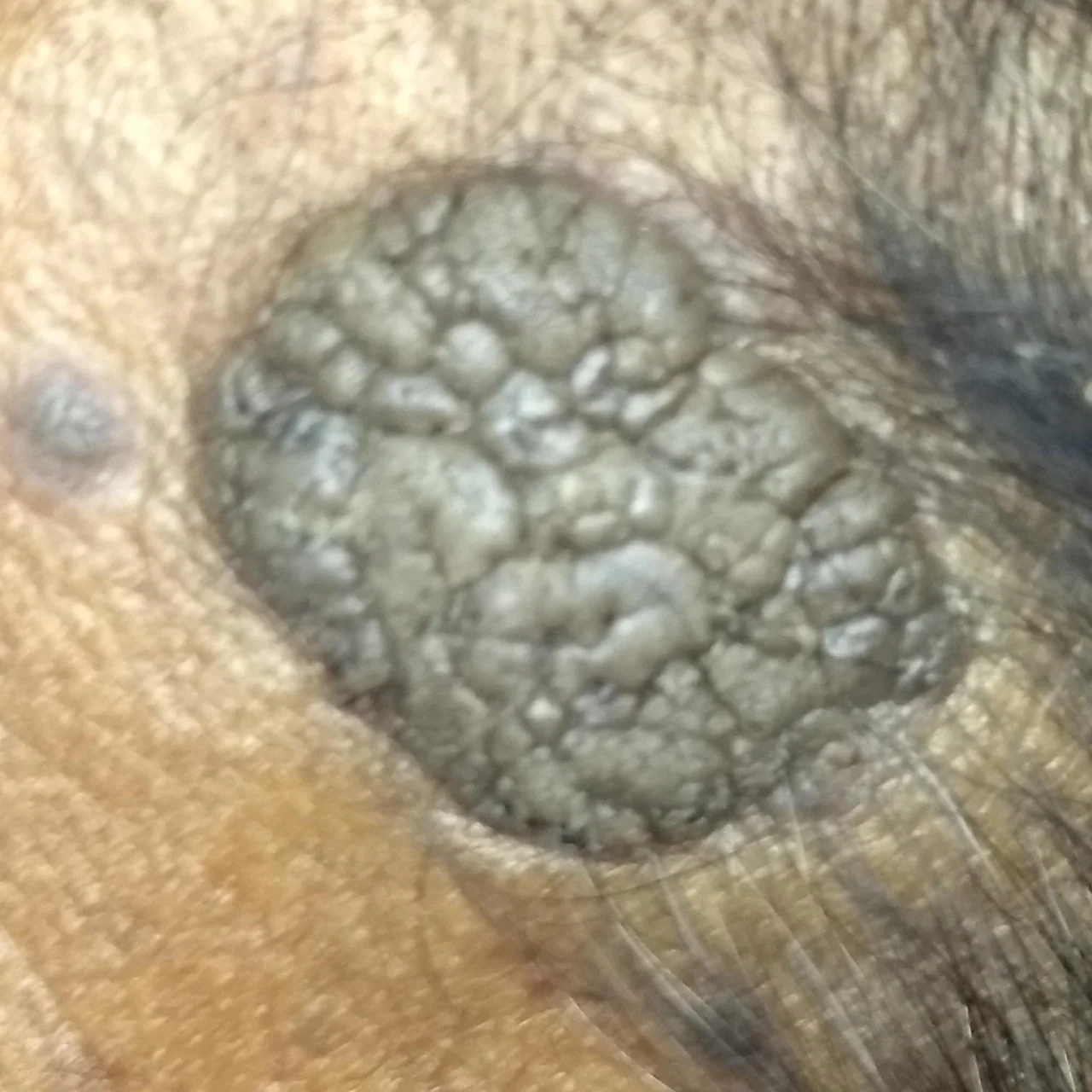 Close-up clinical photograph of the skin of the head of an older adult