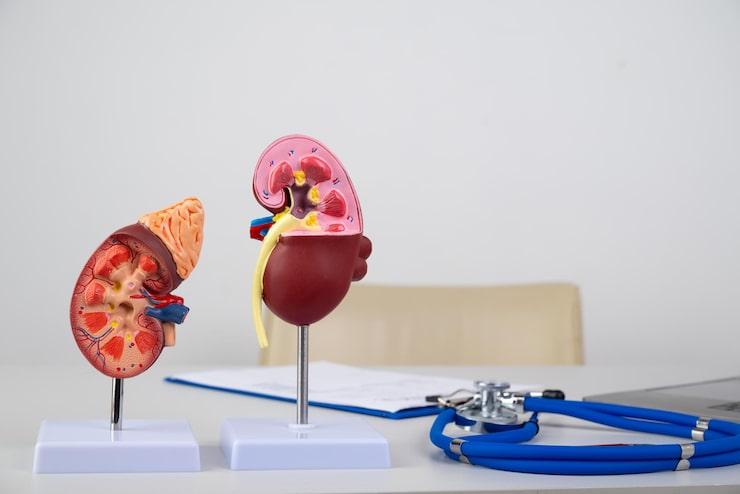 A Basic Guide to Understanding Kidney Stone Removal