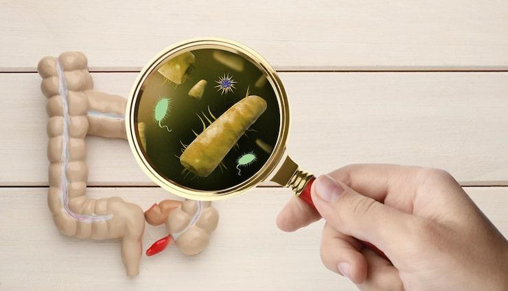 Understanding Crohn’s Disease and Its Treatment