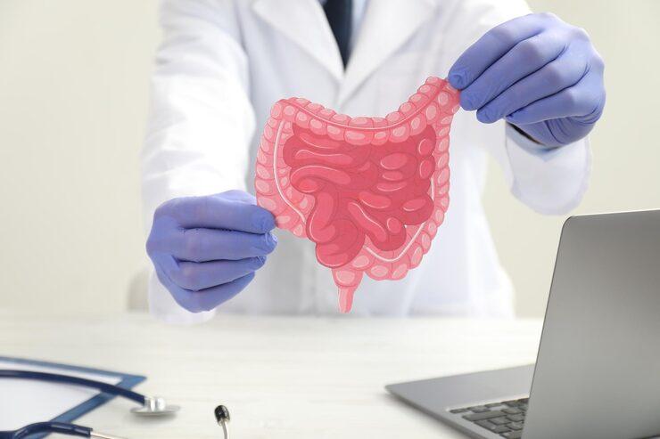 Doctor holding up a picture of the intestines