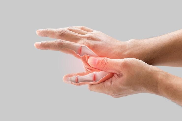 Things You Should Know About Carpal Tunnel Surgery and How to Recover.