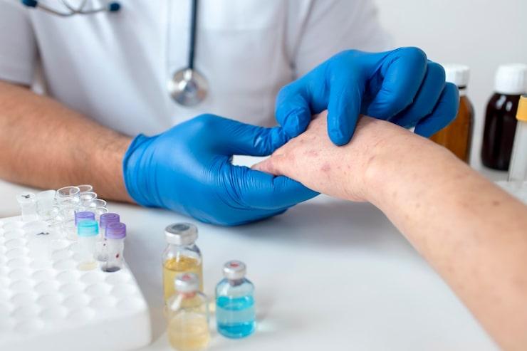 a doctor examining a patient’s warts