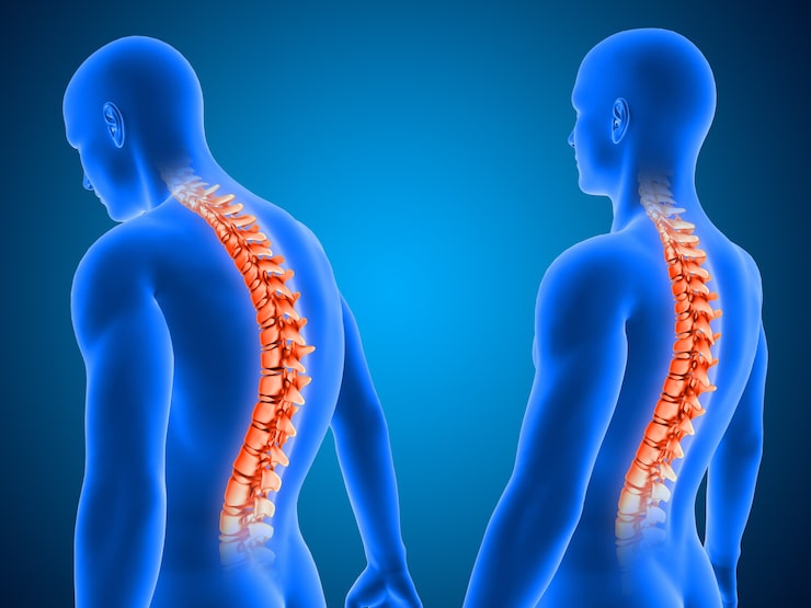 A Full Guide for Patients on Back Surgery and Its Causes