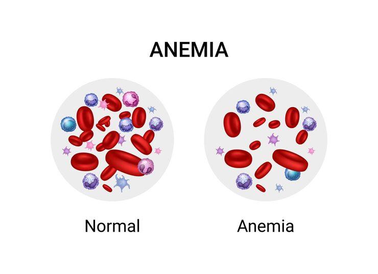 an illustration portraying the difference between anemia and normal blood