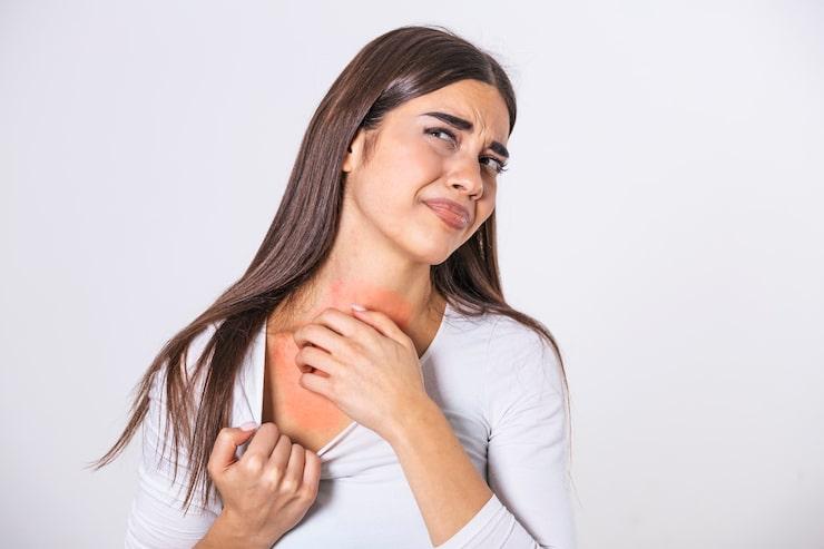 How to Find and Treat Eczema