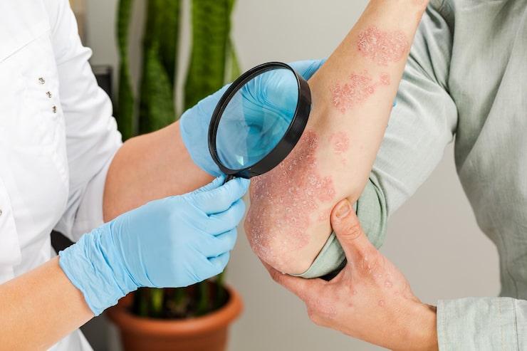 doctor examining patient’s eczema