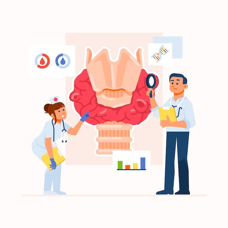 Illustration explaining esophageal cancer