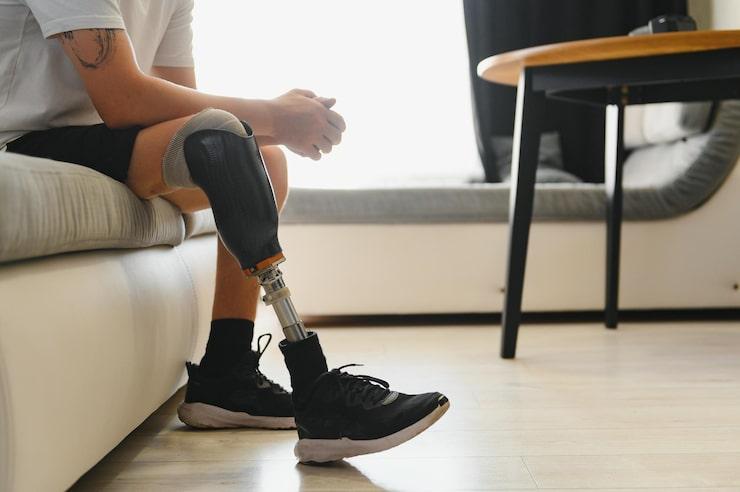 All You Need to Know About Amputations: Causes, Procedures, and Recovery