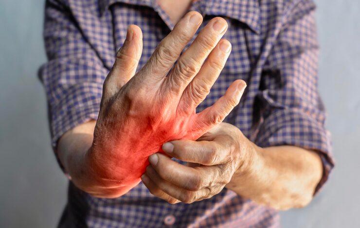 Person suffering from septic arthritis