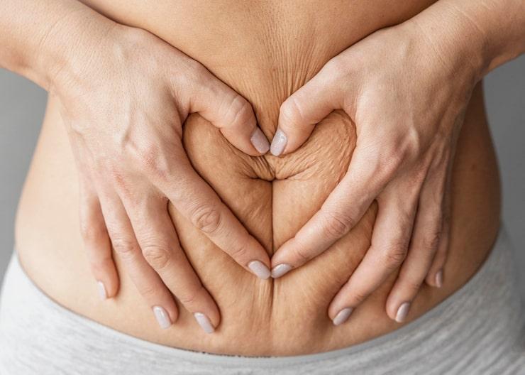Understanding Cellulitis: Causes, Symptoms, and Treatment
