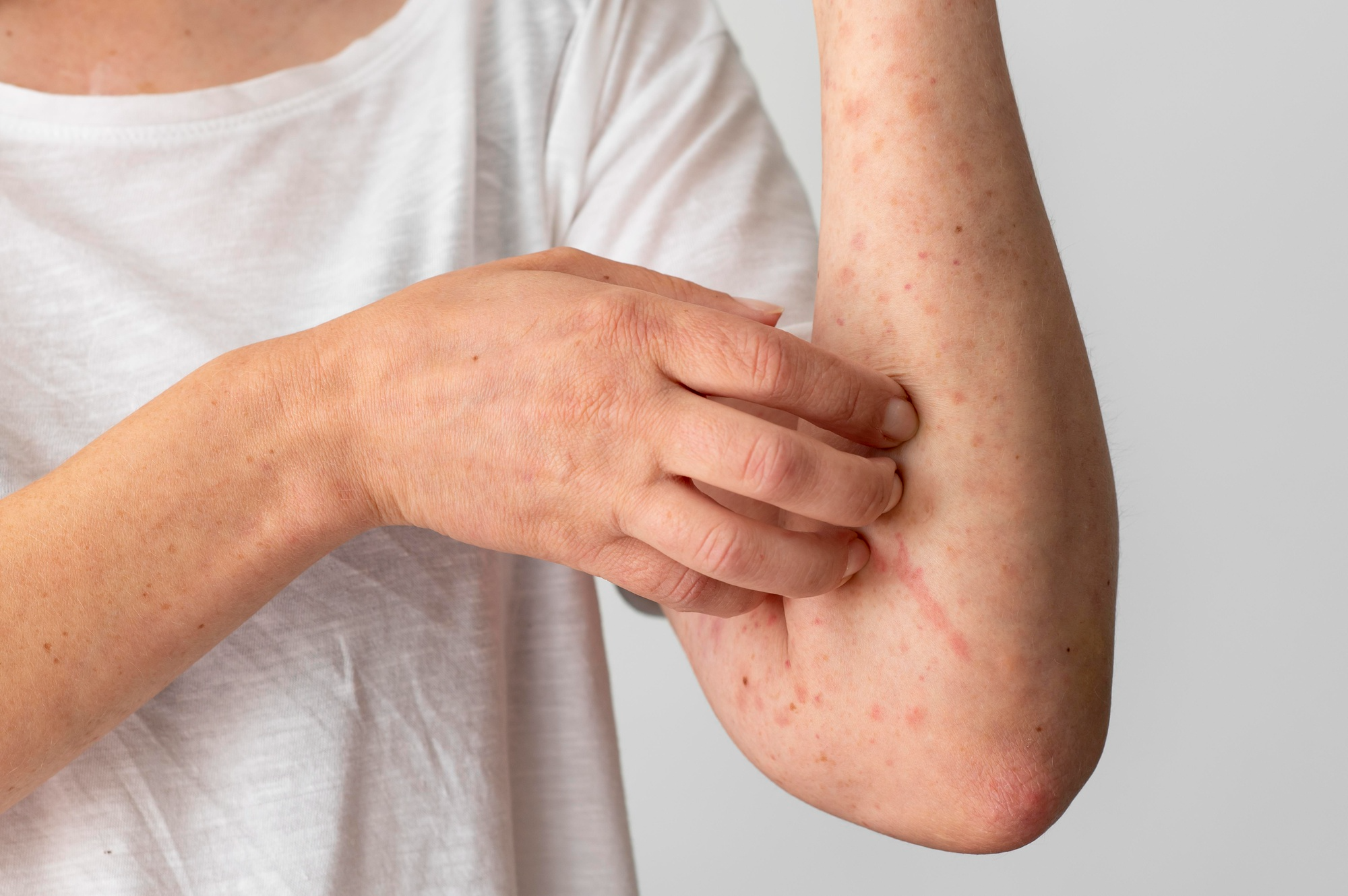A person experiencing skin allergy with redness, itching or rash on the skin.