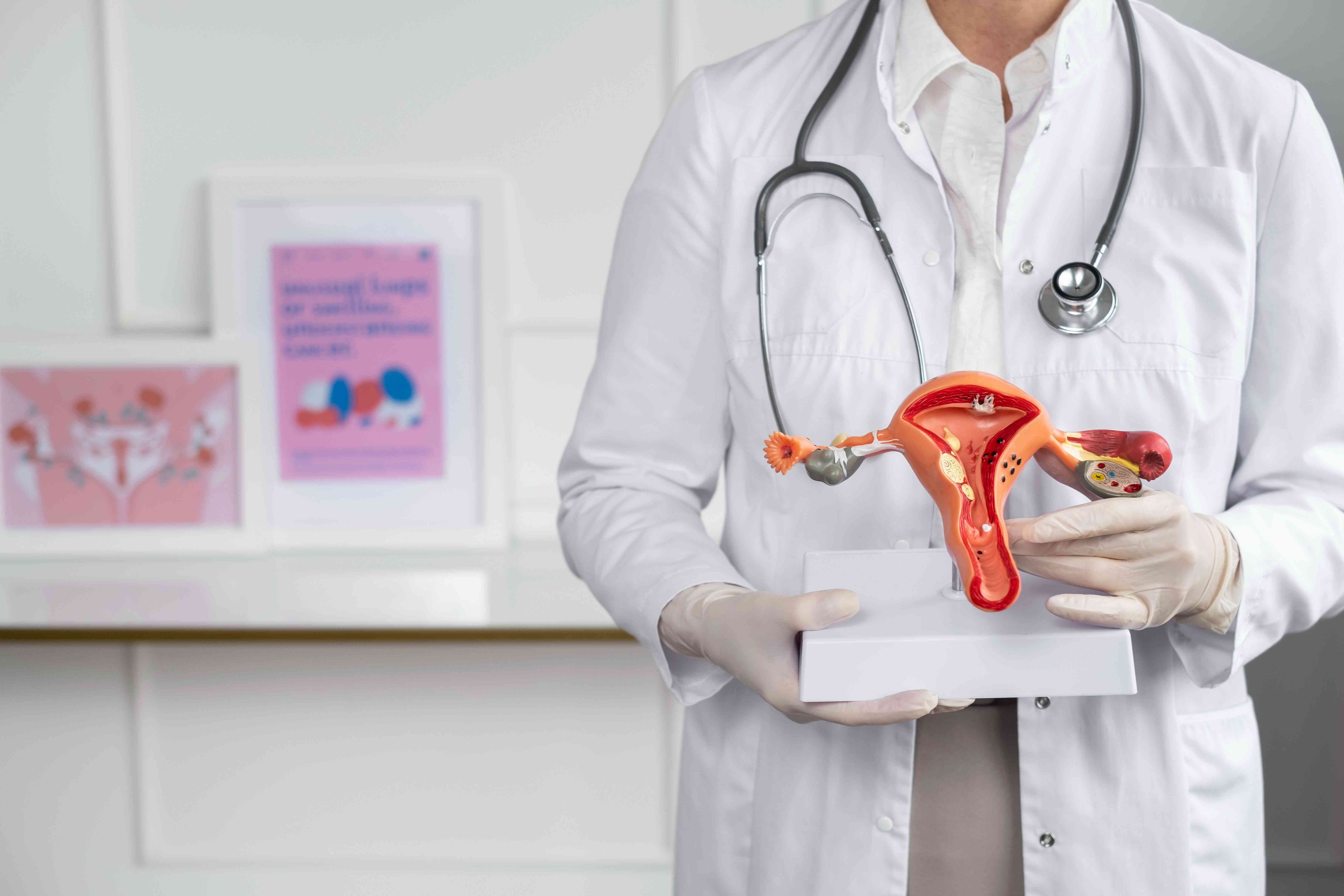 Female doctor holding a 3D anatomical model of the female reproductive system in a clinic.