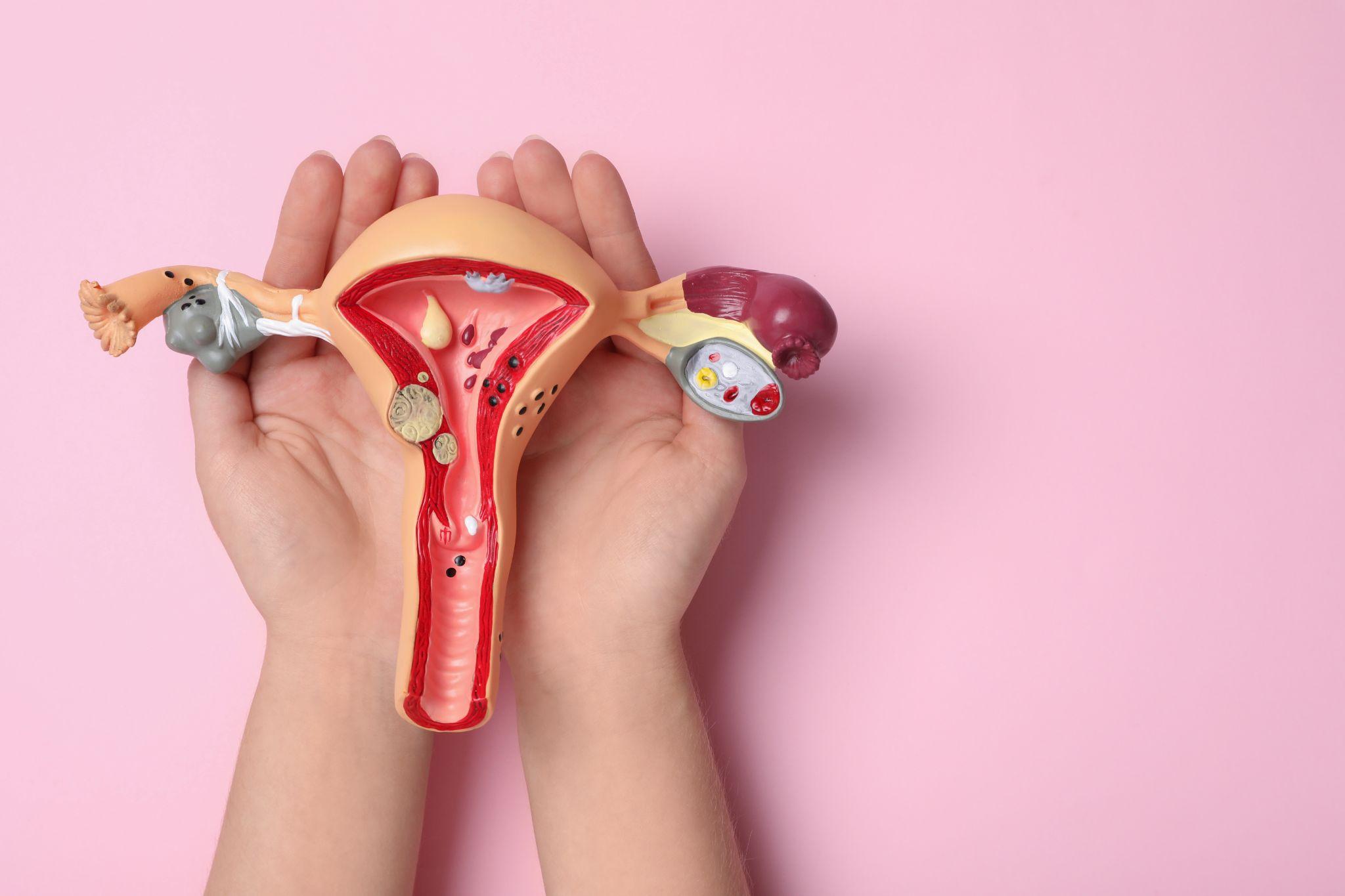 How to prevent cervical cancer